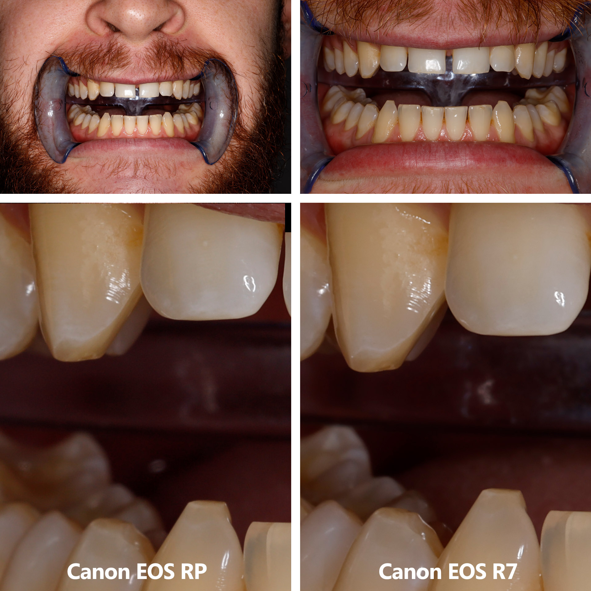 Różnice pomiędzy pełną klatką i APS-C w fotografii stomatologicznej